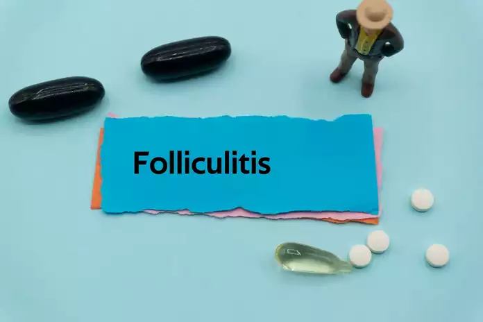 Folliculitis Treatment & Management